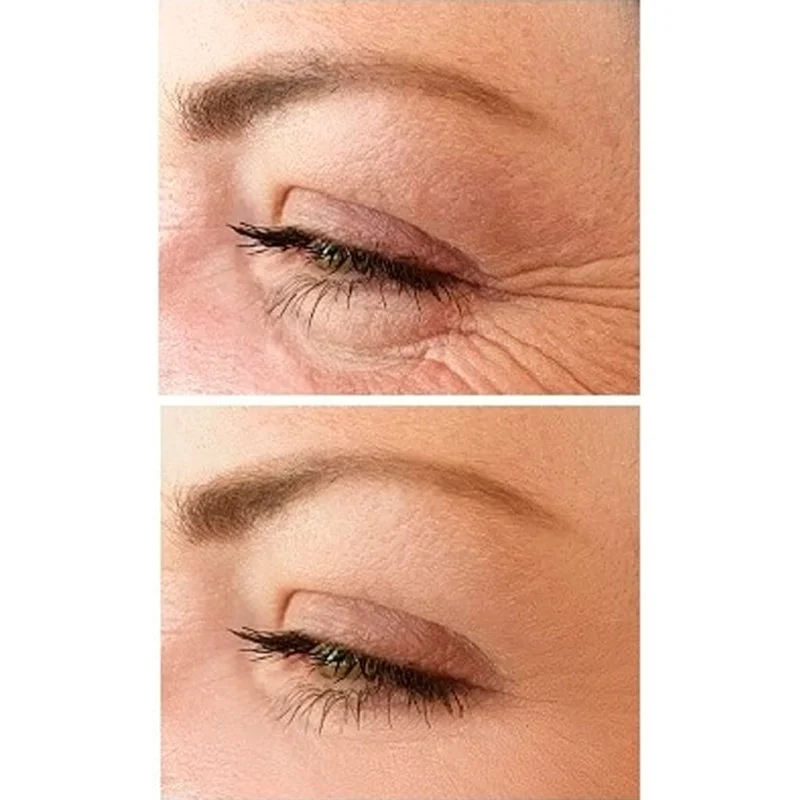 No.1 Creme de Olhos Lifting 15 ml