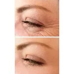 No.1 Creme de Olhos Lifting 15 ml
