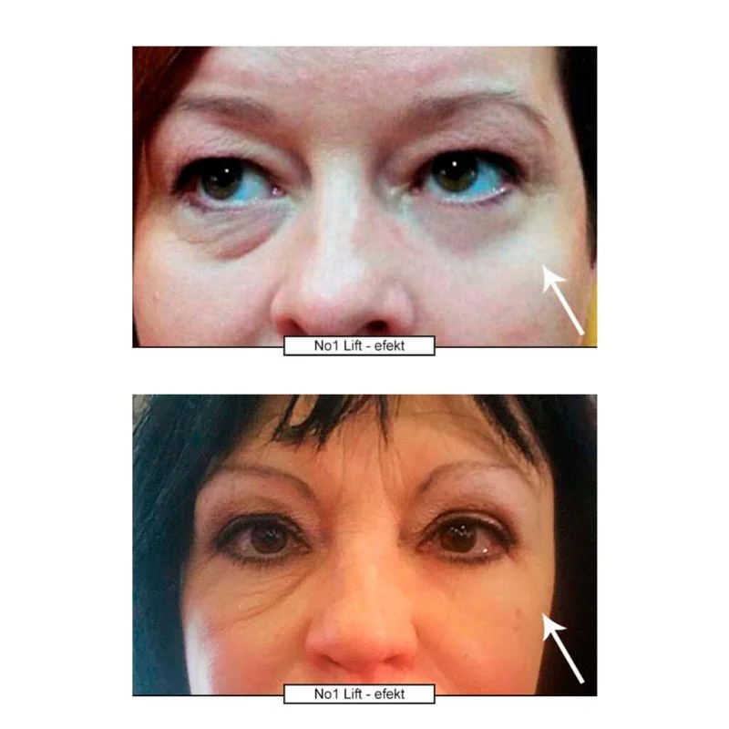 No.1 Creme de Olhos Lifting 15 ml