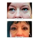 No.1 Creme de Olhos Lifting 15 ml