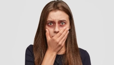 Como tratar hematomas usando métodos naturais comprovados